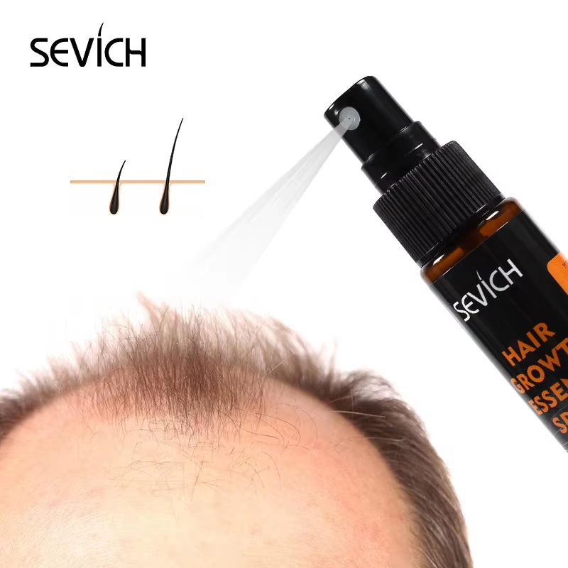 Hair Growth Essence Spray 30Ml Hair Loss Product Hair Regrowth Spray anti Hair Loss Treatment Thicken Thin Hair
